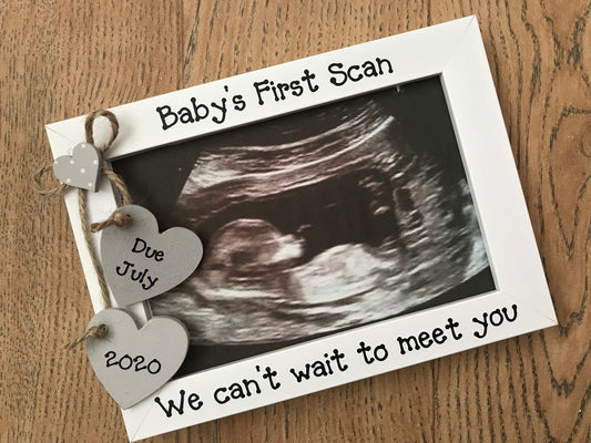 Personalised Baby Scan Ultrasound Photo Frame New Parents Keepsake Gift Quick Dispatch